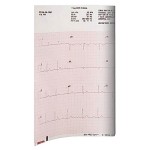 Papel para Electrocardiograma en Hoja ELI 230 Papel para Electrocardiograma en Hoja ELI 230